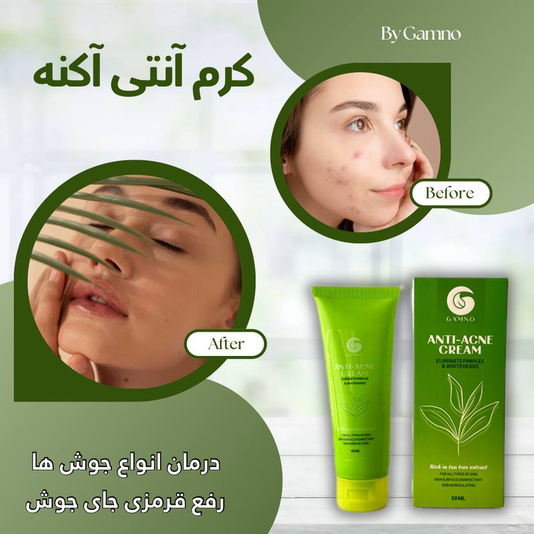 کرم آنتی آکنه گامنو